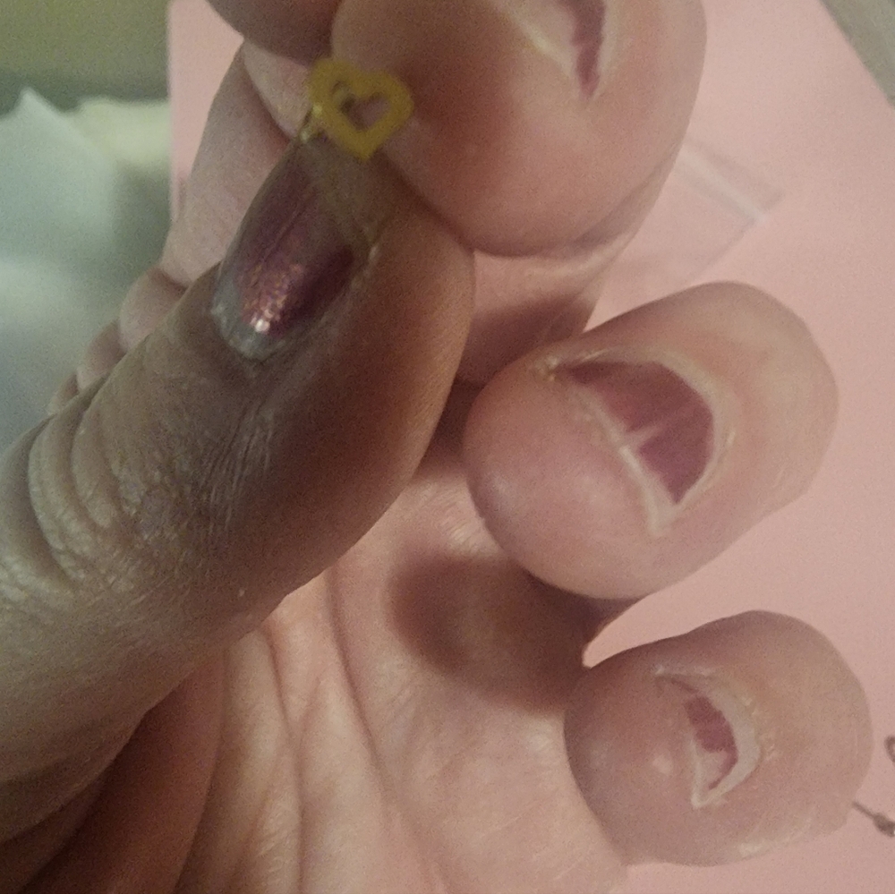 Nose Rings - Picture 3 of 6